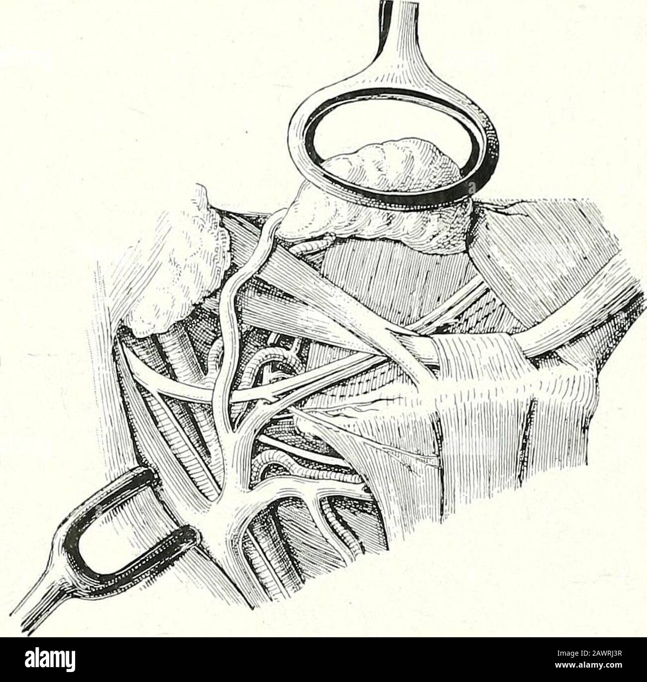 Vena yugular interna y arteria carotida Fotos und Bildmaterial in