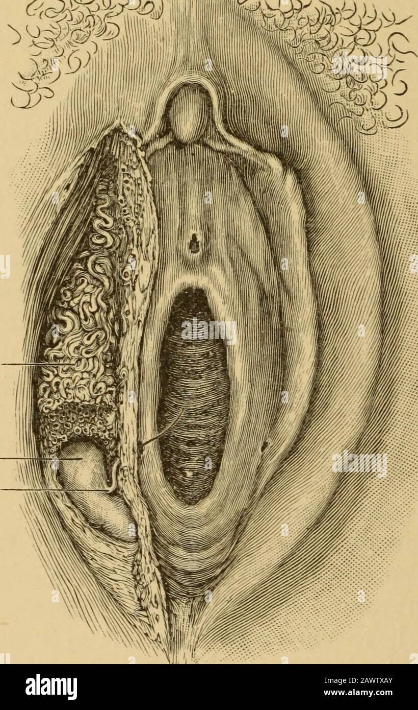 Rosa schleimfluessigkeit