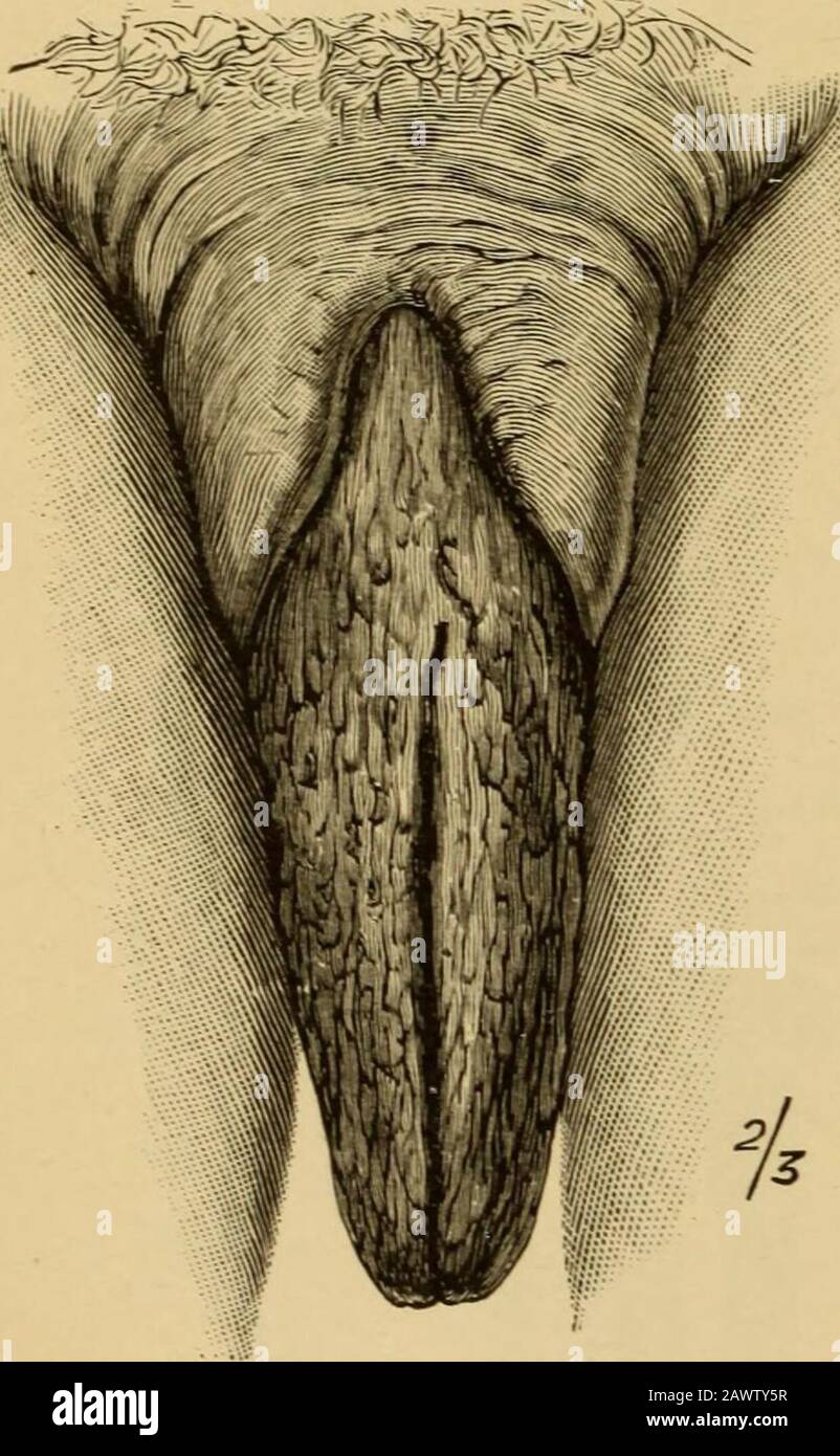 Qin bilan transseksual surat