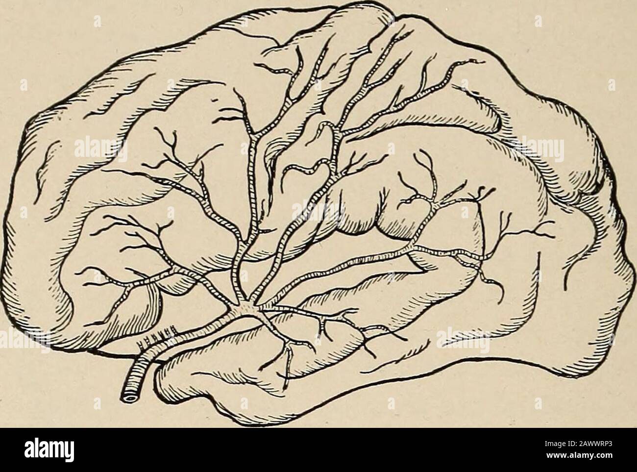 Nervöse und psychische Erkrankungen. Abb. 80.-Charcots-Diagramm der Zirkulation an der Hirndase. 198 ERKRANKUNGEN DES GEHIRNS, DIE VON einem bestimmten Teil des Gehirngewebes stammen. Diejenigen, die sich auf den Zellkern, die innere Kapsel und einen Teil des Thethalamus verteilen, stammen aus dem Stamm des mittleren Gehirns. Insbesondere Onein, die dritte Schicht des Lentikularganglions, des Caudat-Zellkerns und des oberen Teils der Kapsel zu versorgen, ist der Sitz der Ruptur, den es von der Charcot-Threarterie der Gehirnblutung hieß. Abb. 81.-Verteilung des mittleren ce Stockfoto