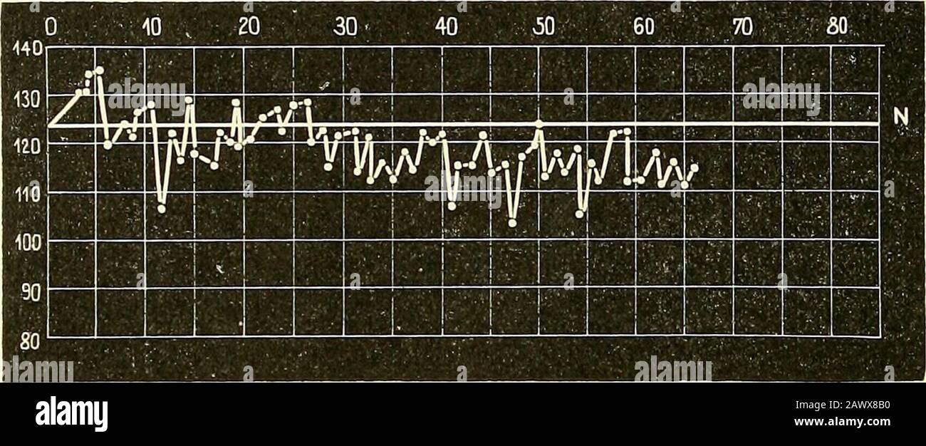Narkologie: Ein Handbuch der Wissenschaft über die allgemeine und lokale Schlagerei (Narkosen und Methoden der lokalen Anasthesie) : In 2 Bänden mit zahreichen Abbildern . auerstoffchloroformnarkosenam Menschen auch schnelle keine Speichelbildung im Mund Rachen, nur bei langenund auslaufenden Narkosen zeigt sich deutlich vor, dass er die^formelle Substanz auf der oberfläche parasierte. - 528 - Daß dem Chloroform die toxische Wirkung nicht von der Kommentierung Stockfoto