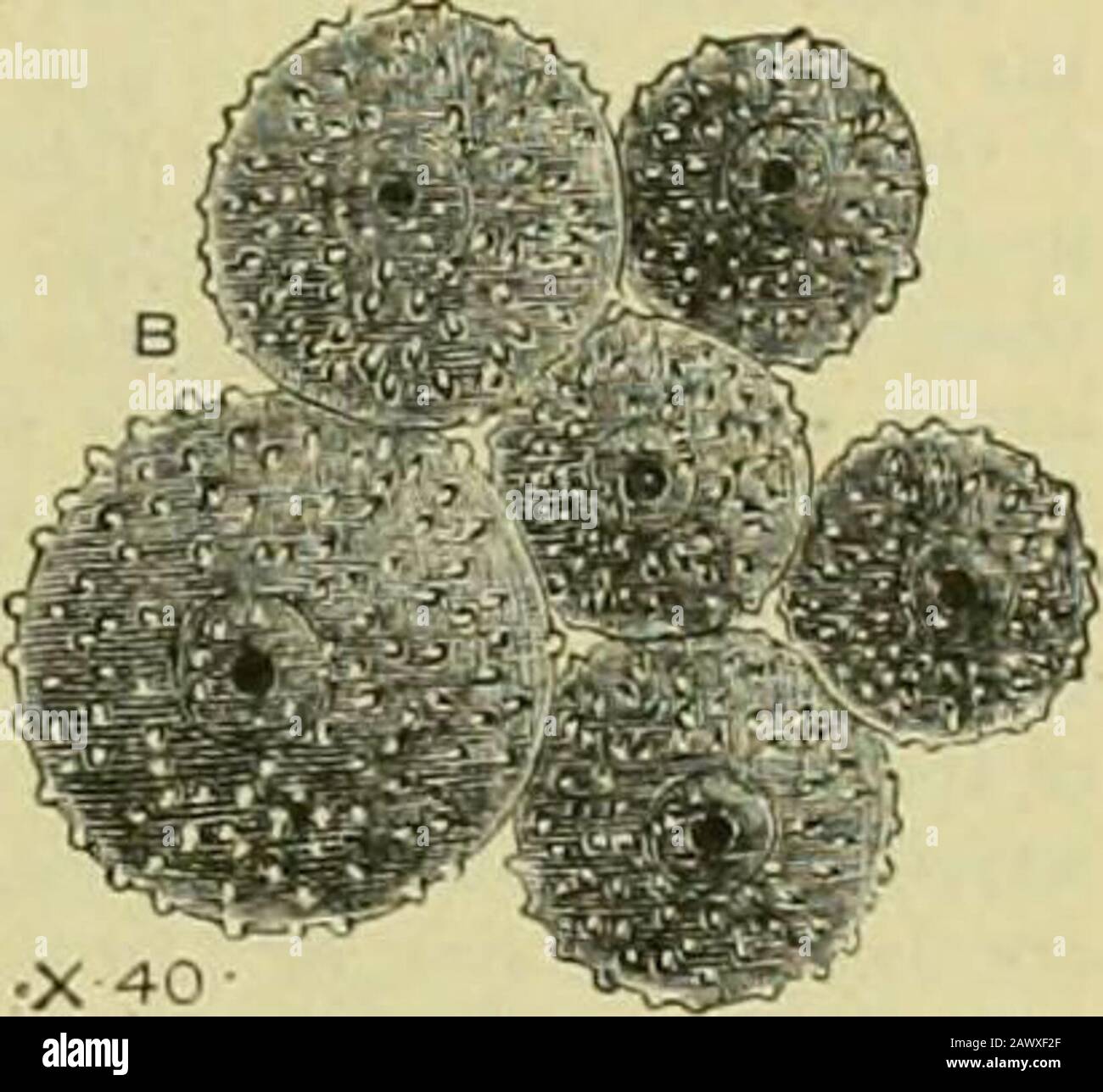 Das Jahrhundert ergänzt das Wörterbuch der Gartenarbeit, eine praktische und wissenschaftliche Enzyklopädie des Gartenbaus für Gärtner und Botaniker . einige der kleineren Zweige, wenn es normalerweise ein Absterben der Triebe in der Nähe gibt; oder es kann zuerst auf dem Stamm selbst gesehen werden. Die Rinde ist stark gerissen (siehe Abb. 200, A); und wenn solche Risse sorgfältig im Frühjahr untersucht werden, werden Gruppen tiefroter Punkte gefunden.Diese werden als Perithecia bezeichnet (Abb. 200, B) und theyenthält Sporenlager asoi. Im Herbst davor wurde eine andere Form von Obst entwickelt, die als Konidien, an bekannt ist Stockfoto