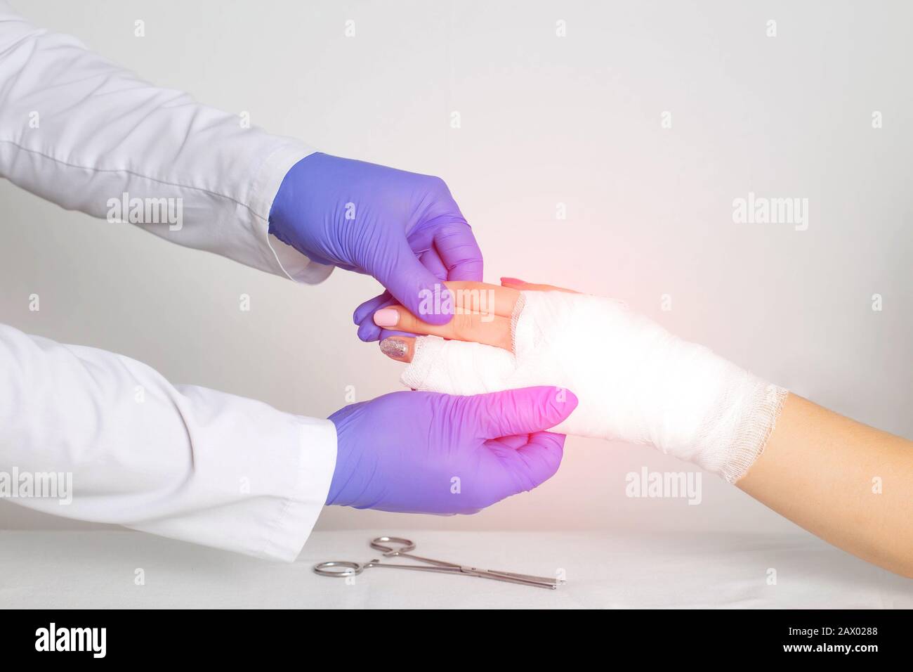 Arzt Chirurg legt einen Splint auf gebrochene Phalangen von Fingern auf eine Hand, Nahaufnahme. Fingerfraktur mit Verschiebung, Kopierraum Stockfoto