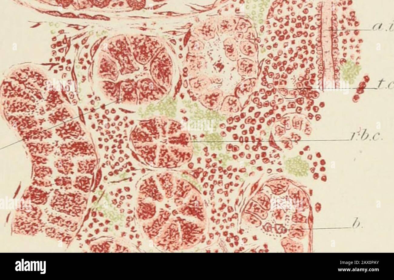 Praktische Pathologie; ein Handbuch für Studenten und Praktiker. // y r. *^ - * ". G.S.K Fu;. 112.-Akute Narrenaluiale Nephritis; Tod am achten Tag. Sek-tion mit Karmin befleckt und in Farrantss Sohition montiert.(X300.) a. Epithehum im fortgeschrittenen Zustand des trüben Schwitzens. B. Beginnend mit dem Katarrh im Tubulus vermehren sich die Zellen, einige davon gelöst von der Liie tiefere Zellen, die mehr oder weniger abgeflacht sind.A.I. Arteria interlobularis, arteria hicli is a great amount of roundcell infiltration.;-./.(?. Farbige Blutkörperchen.(.c Abschnitt des atrophierten Tubulus, komprimiert durch die runde Celledexudation.Ji.i. Stockfoto