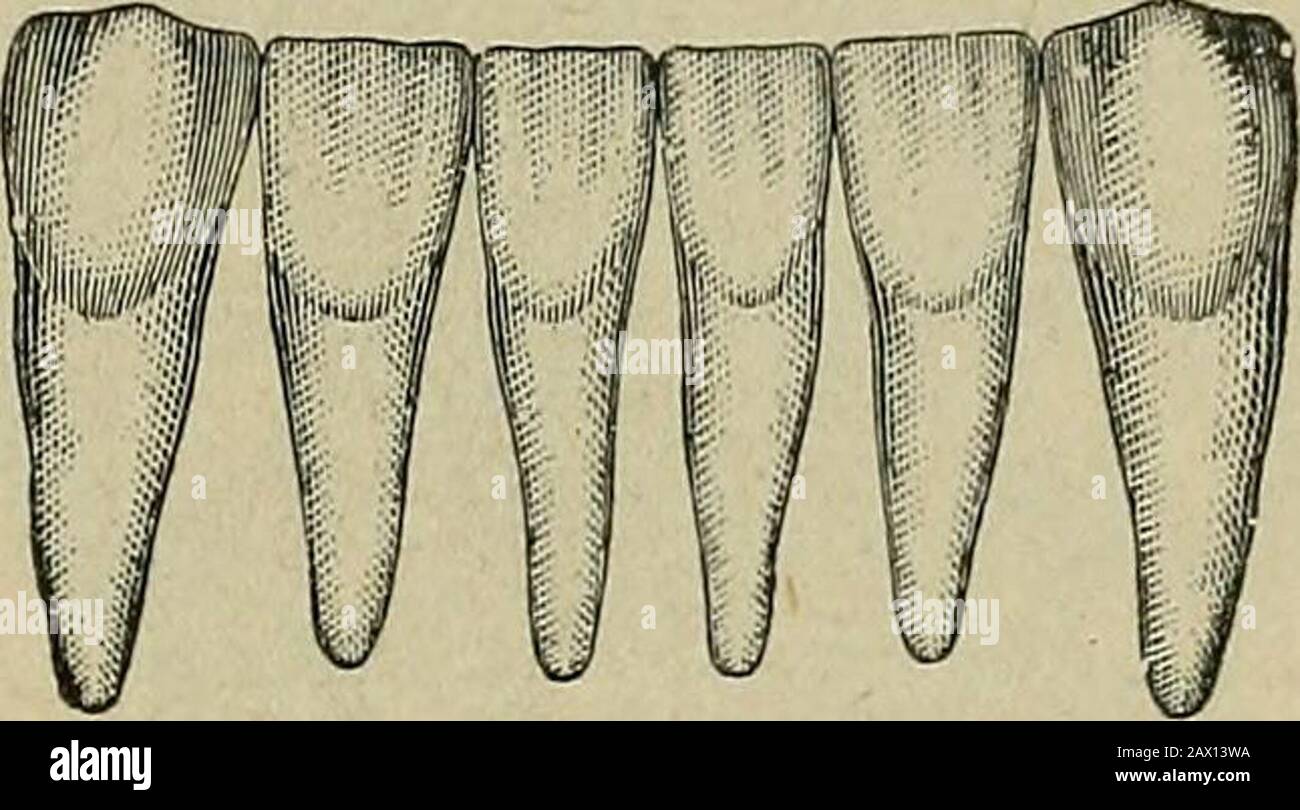 Die Ätiologie der ossealen Deformierungen von Kopf, Gesicht, Kiefer und Zähnen . die Säulen der überragenden und inferiordentalen Bögen werden nach vorne getragen. In diesem Fall ragen die Schneidezähne am Oberkiefer heraus. Wenn die Vorwärtsbewegung der hinteren Säule auftritt, wird sich der Schneidezahn (oranterior Säule) wie die Stacheln eines Ventilators aneinander vorbeidrängen, sofern der Druck in beiden Lateralbögen gleichmäßig ist. Die sechs Zähne, die für die Verformungen DES KOPFES, DES GESICHTS, DER KIEFER UND DER ZÄHNE 417 entscheidend sind, sind in Abb. dargestellt. 155.Diese Zähne sind, wie l)e beobachtet, keilförmig; dei Stockfoto