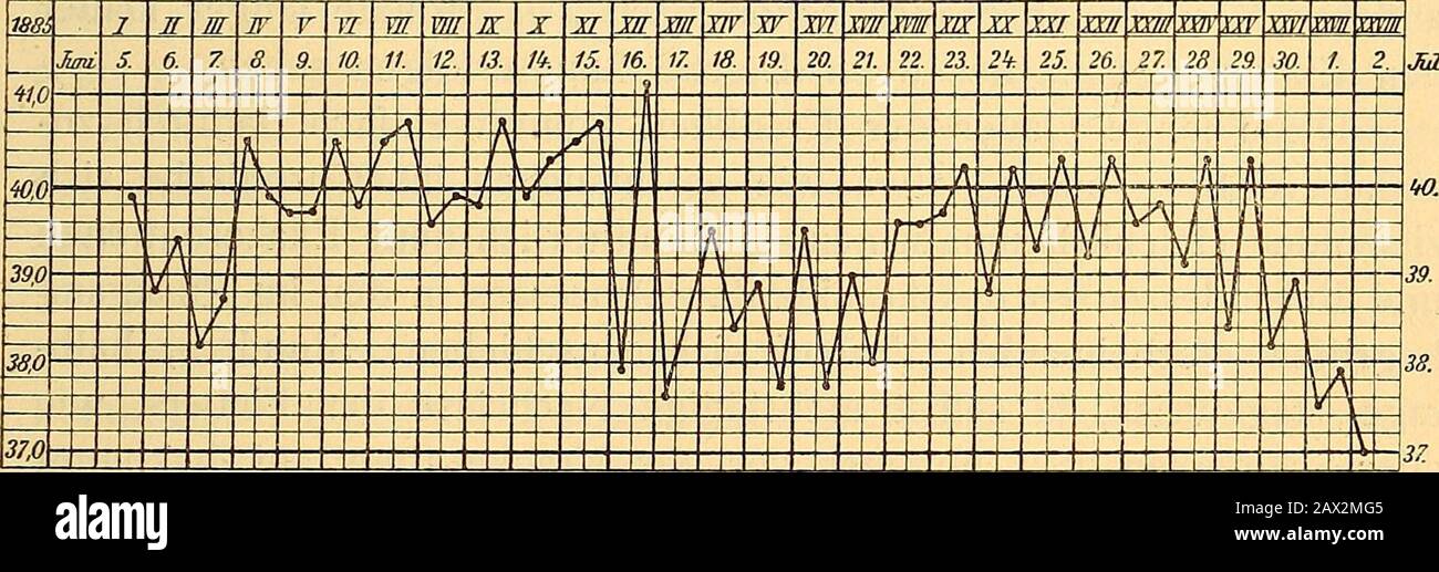 Lehrbuch der Kinderheilkunde. Nsorganen begegnet man anfangs oft einemstarken Schnupfen, zuwärts Nasenbluten. Ein Mal sah ich auch imVerdienst starke Epistaxis autf mit einer deutschen Besse-rung der Koppschmerzen und der sonstigen Erscheidungen. Ferner 11. Kapitel. Cerebrospinalmeningitis. Klinisches Bild. 577 kamen Bronchiten und auch Katarrhalpneumonien vor, doch stehendiese an Wichtigkeit beim Genickkrampf erheblich zurück. Die Nierenkönnen auch bei dieser Infektionskrankheit in Der Mit-identität werden, wenn auch selten. Noch als klinischerPraktiker sah ich eine Schwe Stockfoto