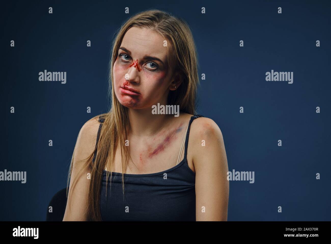 Betrübt blondes Mädchen in schwarzem Unterhemd. Blutendes Gesicht mit Prellungen bedeckt, mit Blick auf die Kamera, vor blauem Hintergrund sitzend. Häusliche Gewalt Stockfoto