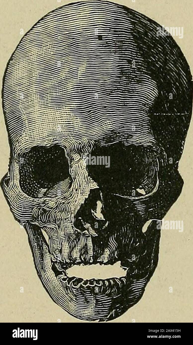 Die Ätiologie der osseösen Deformitäten von Kopf, Gesicht, Kiefer und Zähnen. - . - . Vertikaler Durchm., . - - Über Scheitelpunkt von Ohr zu Ohr, -Occipitalprobierung bis Nasenwurzel, Bimastoide Diam., - . - - - - - - - - - - - Vorderes Grenz-Foramen magnum zum superioccipitalischen Winkel, - - - - - die überragende Maxille wird festgenommen - 74. Es? 51,2 c. - 26,6 c 23,8 c. - 161 mm. 152 mm. - 140 mm. 318 mm. - 293 mm. 121,5 mm. - 96 mm oder 130 mm Entwicklung, KOPF, GESICHT, KIEFER UND ZÄHNE 147 sowie die Knochen des Gesichts. Das Gewölbe ist mittelhoch und die alveolären Prozesse gut entwickelt. Es wird gewollt Stockfoto