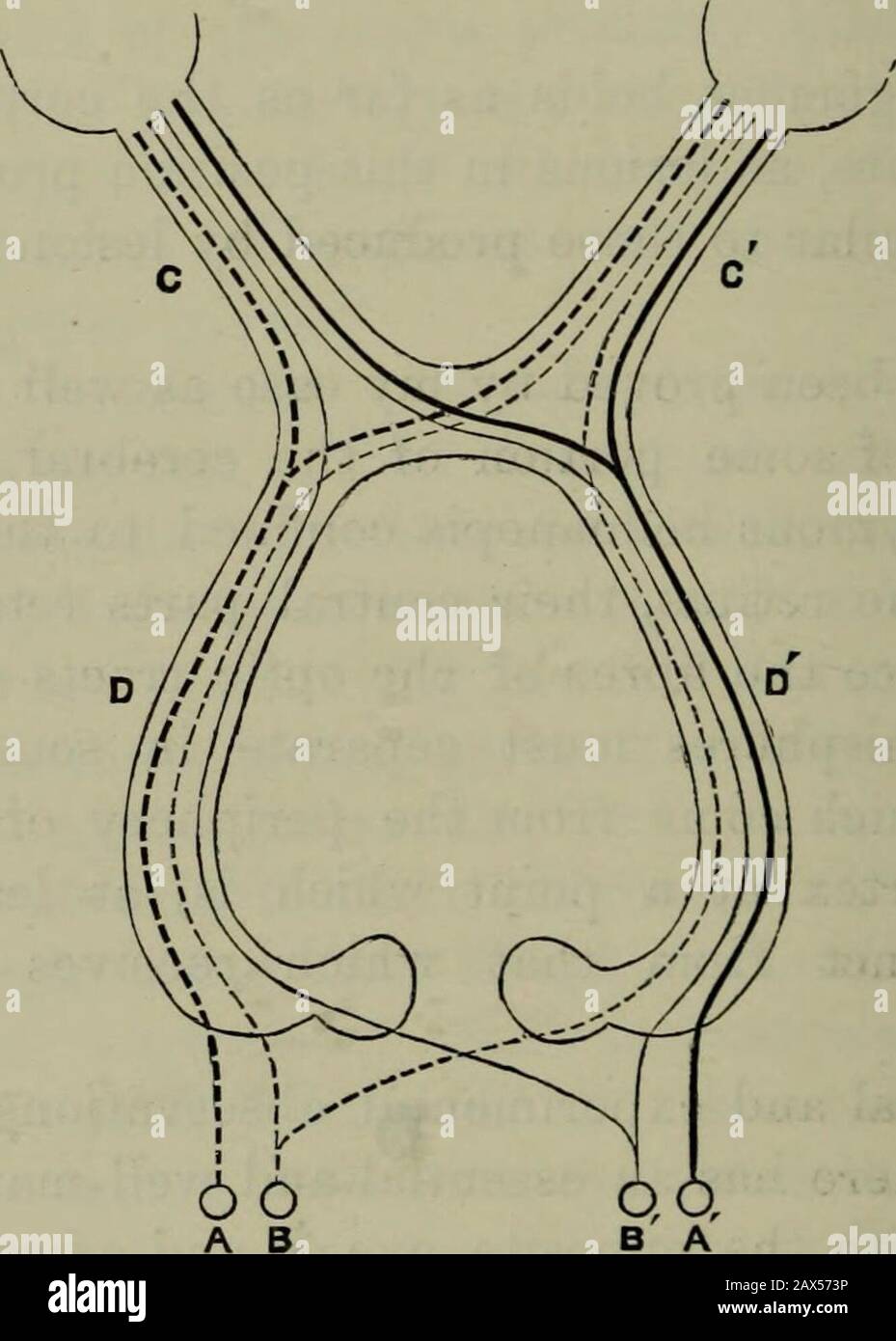 Transaktionen . Trans./ 1883, Bd. Ixvi, S. 293, ein Papier des Autorenkers, das einen Fall Der Asymmetrie des Gehirns darstellt, der Besonderheiten aufweist, die auf Die Frage der Verbindung zwischen den Optiknerven und bestimmten definitiven Bereichen der Großhirnrinde eingehen. Siehe auch * Med.-Chir. Trans., 1884vol. Ixvii, ein Papier des Autors mit dem Titel Embolie der Arteria Cerebralis RightMiddle, die Linke Hemiplegie und Hemiana3sthesia produziert.Absorption eines großen Teils der Rechten Hemisphäre. Tod Seven Yearslater.* 282 ERKRANKUNGEN DES SEHNERVS. Nun^ die Läsionen der optischen Trakte, wie bereits erwähnt, Provetliat Th Stockfoto