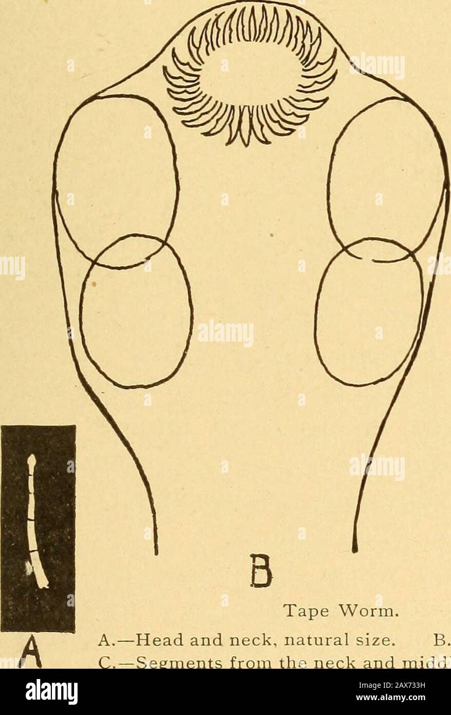 Die menschliche Maschine, ihre Pflege und Reparatur, oder wie man den Körper entwickelt, die Gesundheit bewahrt, Notfälle trifft, die Kranken pflegt und die Krankheit behandelt; . bleibt äußerst minutenlang. Maseres Schweinefleisch ist Schweinefleisch, das diese Hydatiden enthält. Hitze entstroyt sie, aber der Mann oder ein anderes Tier, das rohes oder onlypartially gekochtes Fleisch isst, das hydatids enthält, wird mit 418 ALLGEMEINEN KRANKHEITEN befallen. 419 Bandwürmer. Die Hydatiden sind häufig bei Rindern, Mooren, Schafen, Hunden und anderen Tieren zu finden und nicht sehr selten beim Menschen. Davon sind etwa hundert Todesfälle der Invasion des menschlichen Gehirns durch Echinococcu erfasst Stockfoto