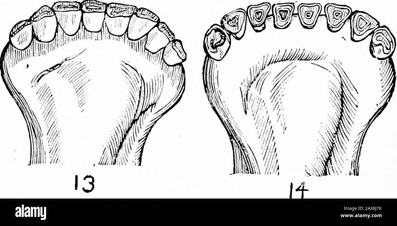 Der praktische Haustierarzt von DrDavid Roberts . 10 II 12. Abbildung 1: Zähne der Kalbsatgeburt, die die ersten beiden in-cisors, Milchzähne, zeigen. Abbildung 2.-Zähne bei zwei verkauften Wochentagen, die vier temporäre in-cisors zeigen. Abbildung 3.-Zähne in Dreierwegekelzen alt, die sechs Schneidezähne zeigen. Abbildung 4.-Zähne im Alter von onemonth, die acht in-cisors oder einen vollständigen Satz zeigen. Abbildung 5.-Zähne im Alter von sechs oder acht Monaten, die die ersten zwei oder mittleren Zähne des Trägers zeigen. Abbildung 6.-Zähne im Alter von 10 Monaten, die Absorptionin den ersten beiden Zähnen zeigen und die Abnutzung von zwei äußeren Paaren zeigen. Abbildung 7.-Zähne im Alter von zwölf Monaten, die Absorption in allen nipp zeigen Stockfoto