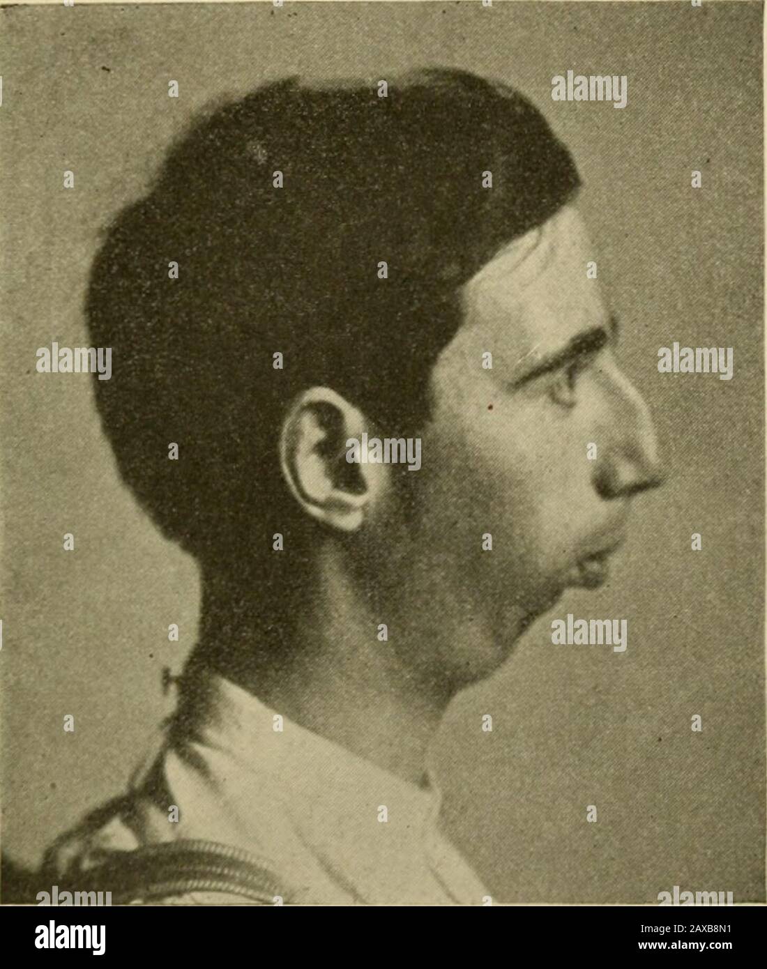 Angewandte Anatomie und Mundchirurgie für Zahnmediziner. N DeDischen