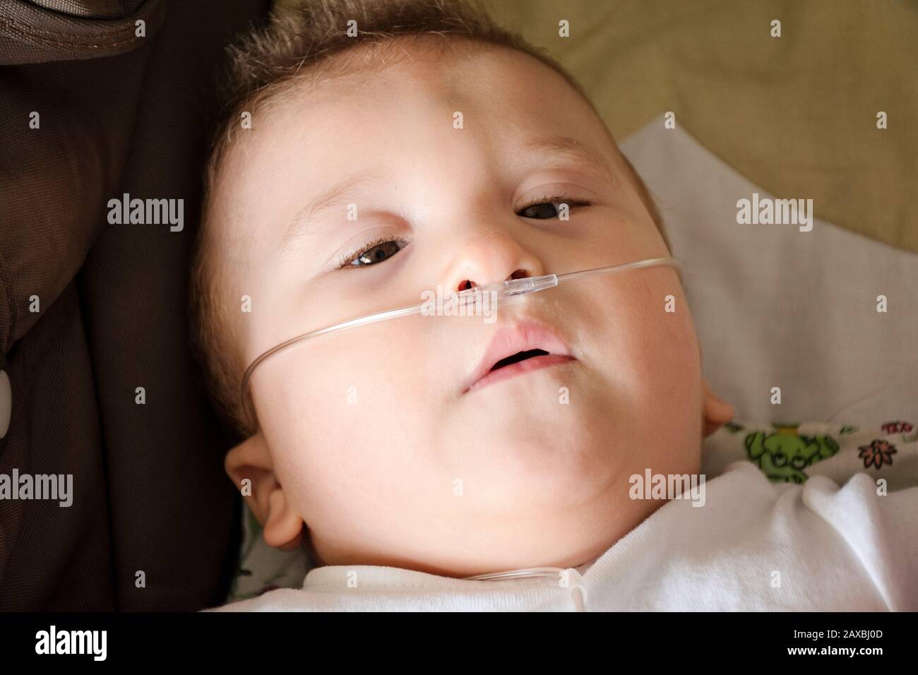 Baby Junge mit zerebraler Pläse erhält Sauerstoff über Nasenprongs, um die Sauerstoffsättigung zu gewährleisten. Nasenkatheter bei einem Patienten im Krankenhaus. Atemschutzmaske Stockfoto