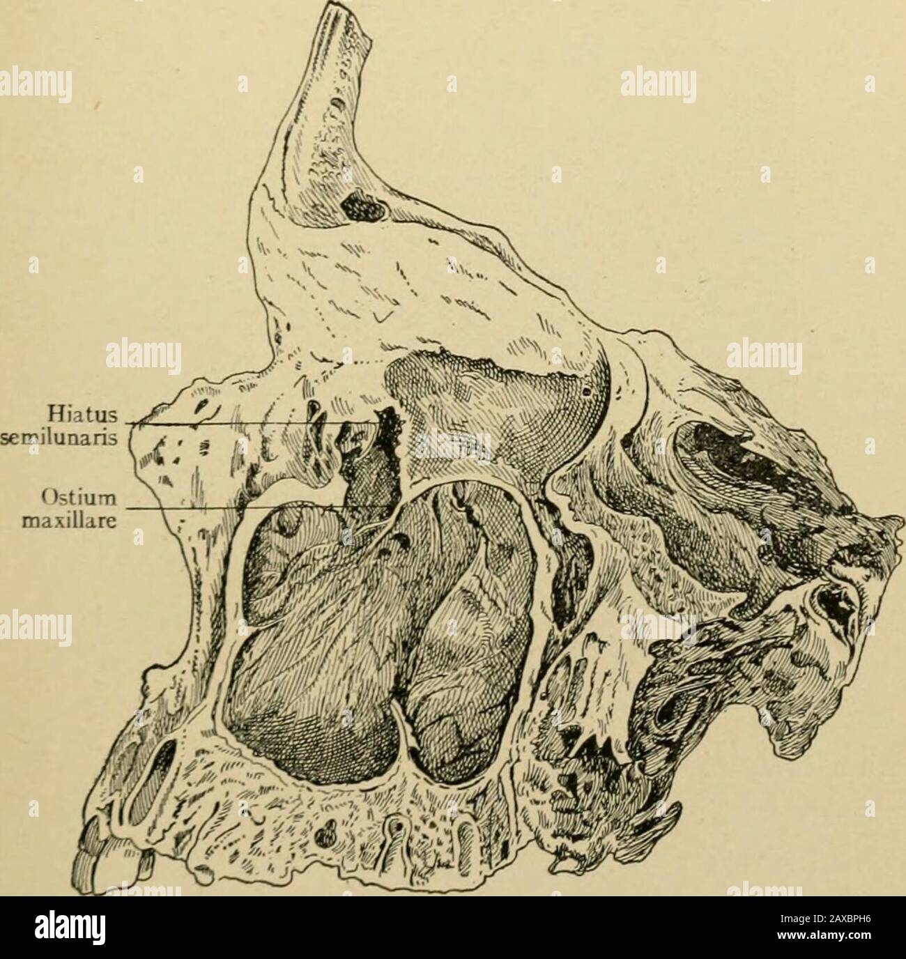 Angewandte Anatomie und Mundchirurgie für Zahnmediziner. Abb. lo.-Transversaler Gesichtsabschnitt, der die Sonde zeigt, die von der maxillaren Sinusdurchführung durch Ostium maxillare und Liatus semilunaris in den frontalen Sinus (Cryer) führt. Alveolarer Prozess. Es präsentiert konische Erhebungen, die an den Apices der Wurzeln des Molaren und einiger Zeiten der prämolaren Zähne korrelieren. Es kann auch partialsepta vorhanden sein, die sich quer ausdehnen. Vollständige Septen sind in der Maxillarsinus neverfund. Knochen 41 Die hintere Wand der Maxillarsinus wird durch die zygomatische Platte der Maxille gebildet, die itvom Sphenomaxill trennt Stockfoto