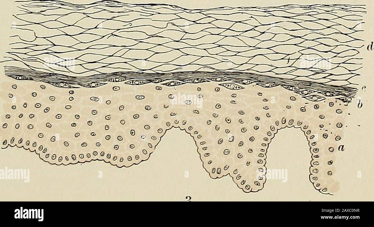 Die Pathologie und chirurgische Behandlung von Tumoren . I. Endotheliom hyalinum aus Kapsel der submaxillaren Drüse (nach Klebs): A, Stroma; B. kleinerer Teil Ofstroma; c, hyaline Substanz; d. Zellen. 2. Micous-Membran aus großem Inte.stine von Schwein; X 350 (nach Klein). Thekapillare Blutgefäße, die in verschiedene Richtungen um die Krypten geschnitten werden, werden mit Karmingelatine injiziert. 3. Avertikaler Abschnitt durch das Epithel, das die Haut bedeckt - Epidermis; X 35 Grad (nach Klein): A, rete Malpighii, orrete mucosum; b, körnige Schicht (Langerhans); c, Stratum lucidum (Schron); d, Stratum corneum. ETIOL Stockfoto