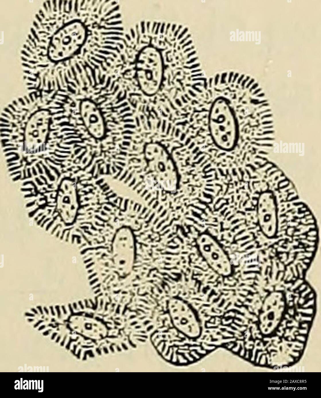 Tumore delle cellule germinali Fotos und Bildmaterial in hoher