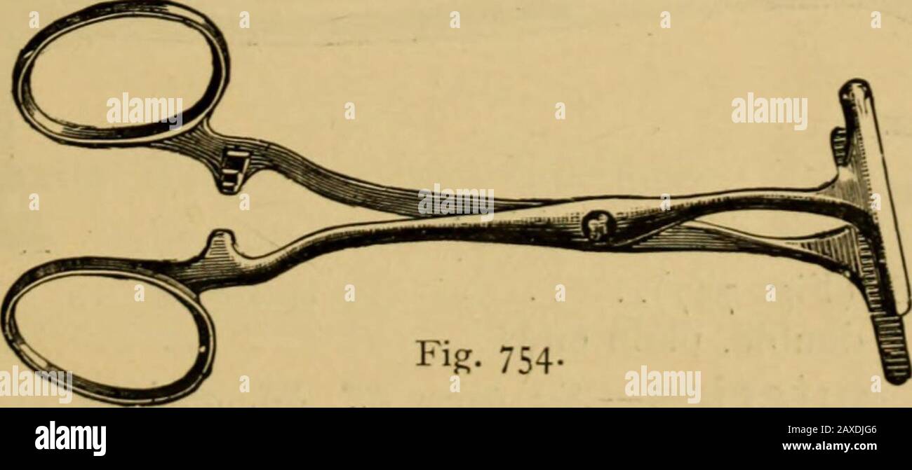 Katalog der Chirurgen Instrumente und medizinische applizierungElektrotherapeutische ApparatusDie chirurgischen und Krankenzimmer, Arzneitruhen usw. Abb. 753-Lawson Taits (Abb. 753) jeweils 3/6. Abb. 754- Thorntons (Abb. 754) je 8/6. Spencer Wells 3/0, Tun. Tun. Aseptisches Gelenk 3/6,, Tun. Winkel 5/6, Hysterektomie-Stift, mit Trocar-spitzem, beweglichem Ende 3/6" Tun. Paten, mit bewachtem Ende. 3/0,, Tun. Tun. Koeberles 3/0, Nadeln, vernickelt - Blunt, für Pedicle 7/6. Tiefe Gebogene 7/6, Do. Metallgriff, vernickelt 8/0, Sharp 5/0, L 182 James Woolley, Sons & Co., Ltd., Manche Stockfoto