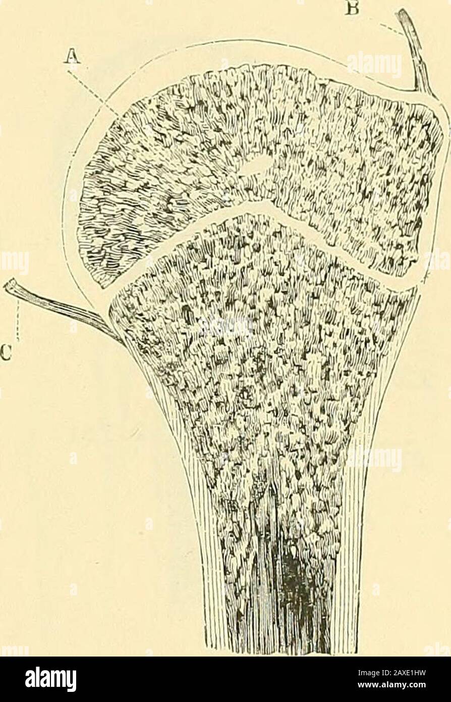 Eine manuelle operative Operation, die die Vena cephalica und eine große Verzweigung der Arteria acromio-thoracica operiert. In der Nähe der Nut und ein wenig belowthe clavicle, kann der Coracoid-Prozess gefühlt werden. Der Prozess liegt jedoch nicht tatsächlich im Intervall zwischen den beiden Muskeln vor, sondern wird von der Vorderkante des Deltoids bedeckt. Der zirkumflex-Nerv und die Arteria cumflex kreuzen den Thehumerus in einer horizontalen Linie, die eine Fmmersbreite über dem Deltoidmuskel als vom Akromion bis zur Deltoideinstülpung als Meas-ured darstellt. Die Arterie ist normalerweise über dem Nerv. Der Punkt, an dem TH Stockfoto