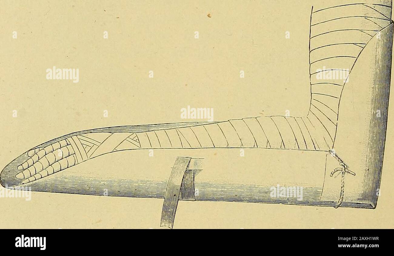 Das Handbuch des Chirurgen zur Behandlung von Kriegsverletzten: Ein Preisaufsatz . STROMEYERS gepolsterter Handsplint. Abb. 121. Einfügeplatte für die arn-Abb. 122. Stockfoto