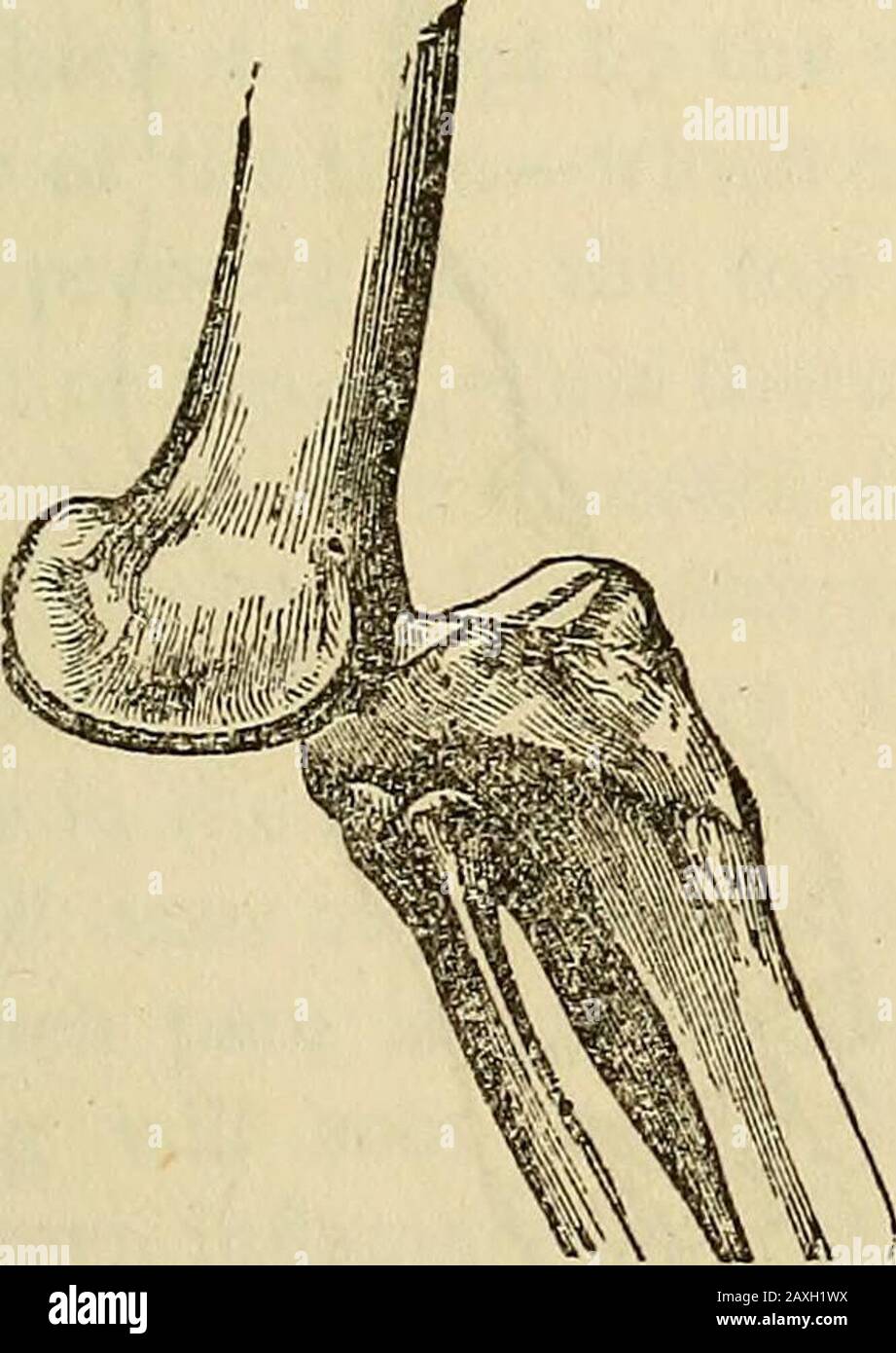 Vorträge über das amerikanische eklektische System der Chirurgie, während diese im Pappelraum wahrgenommen werden. Die Nerven und die Arteria poplitealis haben einen Selbstdruck, um die Pulsationen der Arteria tibialis anterior zu stoppen und mehr oder weniger Taubheit des Fußes zu verursachen. Abb. 63. Abb. 64. Stockfoto