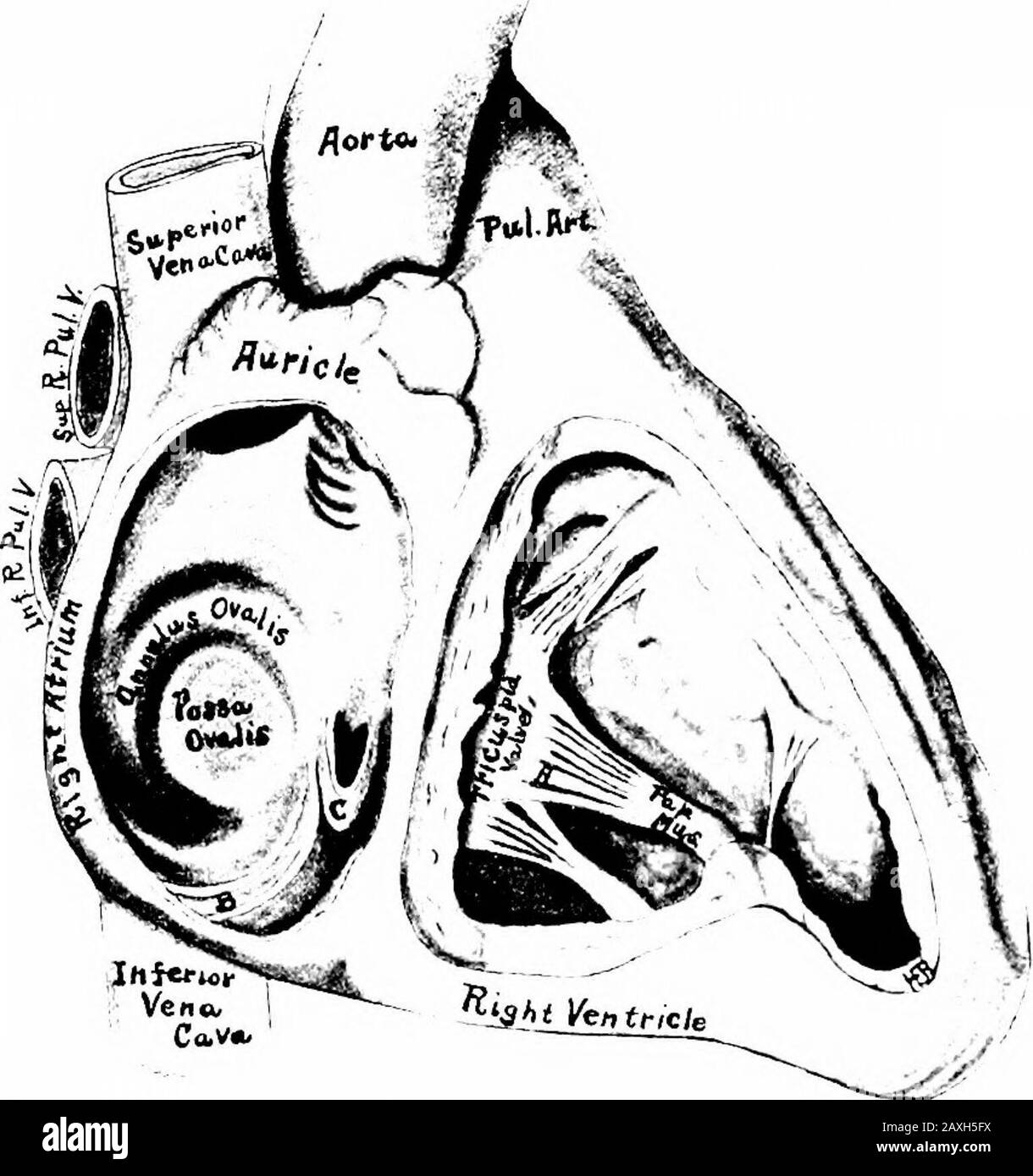 Ein Handbuch der Anatomie . Irinsen. Die Papillarmuskulatur hat normalerweise die Nummer drei: (I) eine Largeventrale, (2) eine kleinere dorsale, (3) eine einzelne oder eine Gruppe von Papillen (Septale), die am interventrikulären Septum befestigt sind. Auf dem Gipfel jedes Areas sind die Chordae tendineae angebracht. 5. Das Moderatorenband, eine modifizierte Säule, die an einem Ende des interventrikulären Septums befestigt ist und an der Basis des ventralen DIE KAMMERN DES MUSCULUS PAPILLARIS HERZ 219. Sie beugt einer Überdistinenz des Ven-Dreizapfen vor und ist bei niederen Tieren prominent. 6. Die Trikuspidalklappe (Valvula tricuspidalis) besteht aus drei Stockfoto