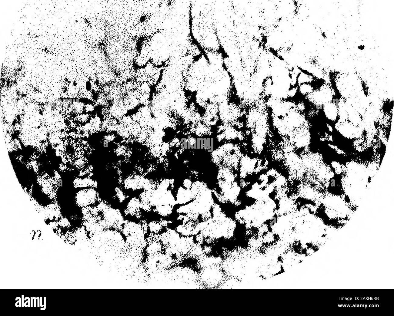 Auf Nerve-End-Zellen im Zahnfleisch. Abb., 5: I > ,: R . r Abb. 7, U >• Fie. 6. Y. Stockfoto
