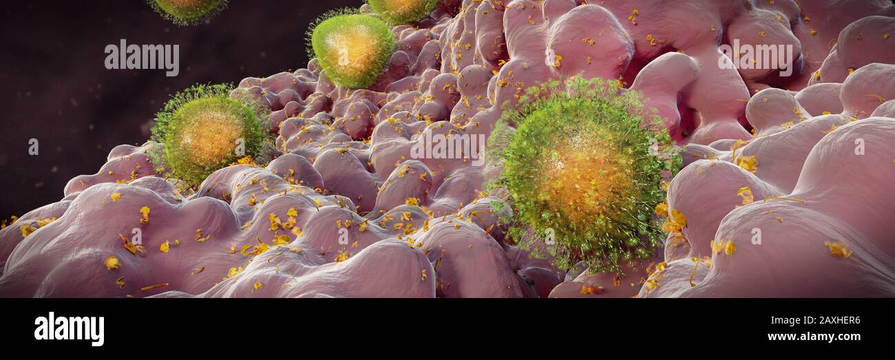 Coronavirus-Ausbruch, das gesundheitsbedrohende 2019-nCoV-Influenzavirus Stockfoto