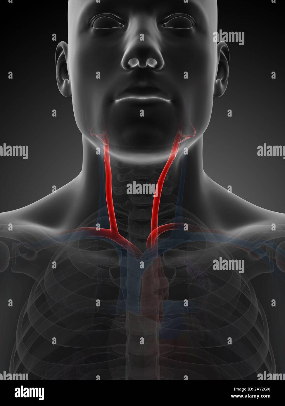 3D gerenderte Darstellung der Arteria carotis Stockfotografie Alamy