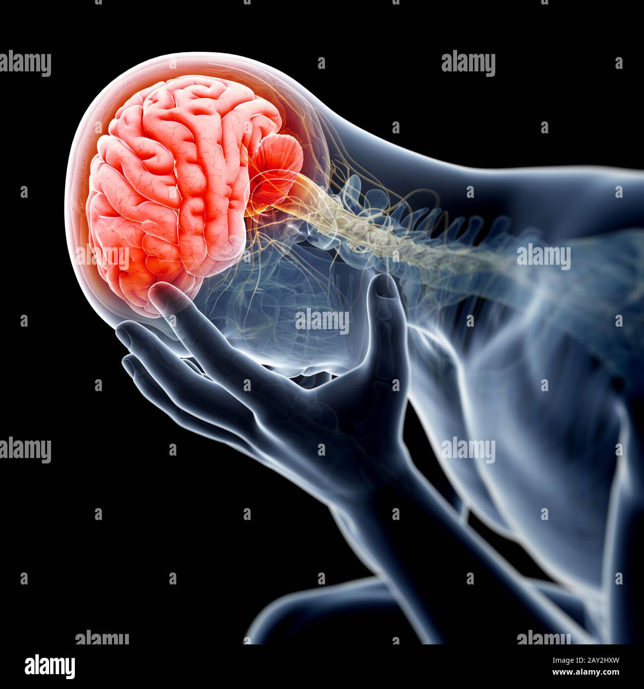 Medizinische Darstellung - geschwollen Stockfoto