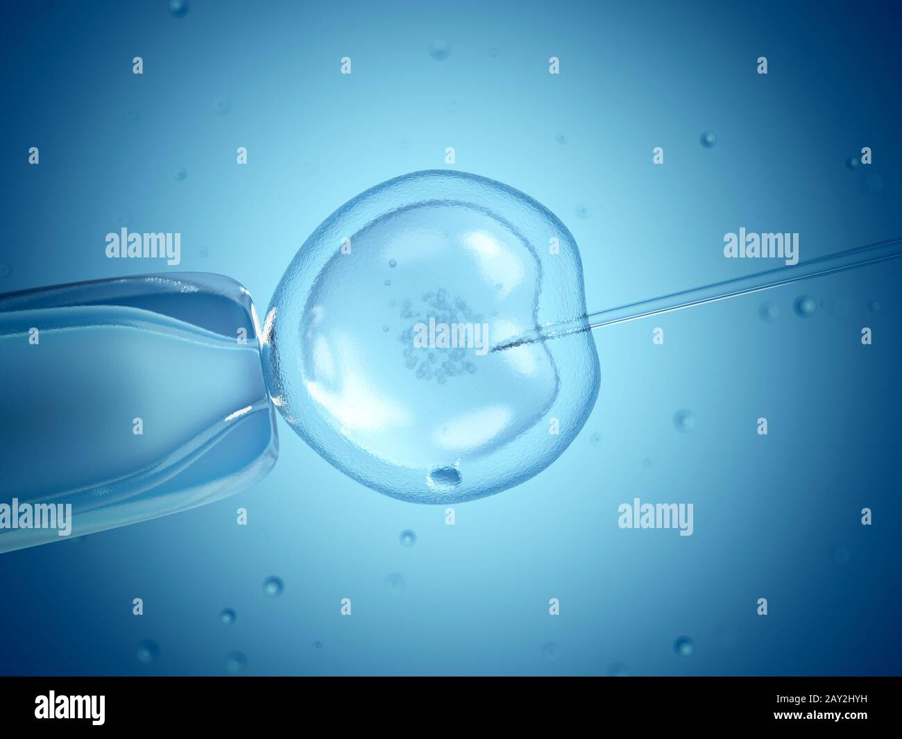 Nahaufnahme der in-vitro-Fertilisation (IVF). Stockfoto