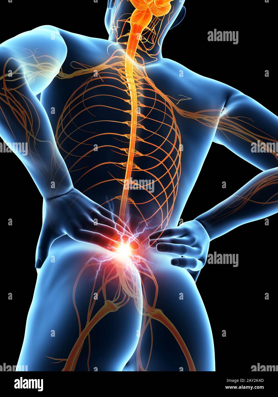 Rückenschmerzen Stockfoto