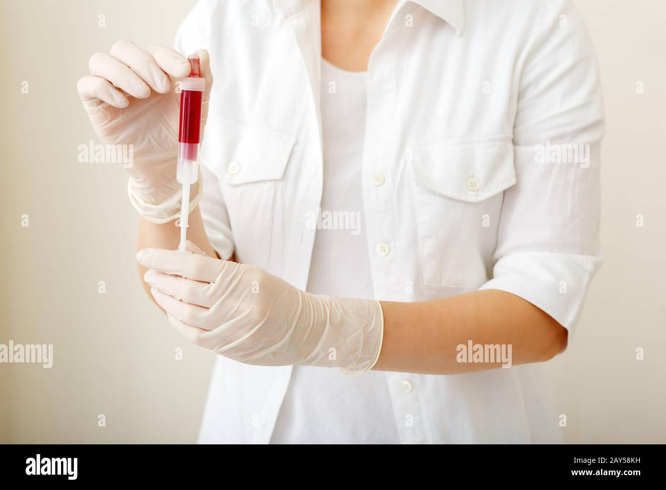 Bluttest im Röhrchen zur Laboranalyse in der Hand der Ärzte. Laboranalyse, biochemische Blutuntersuchungen, medizinische Untersuchungen.weißer Hintergrund mit Stockfoto