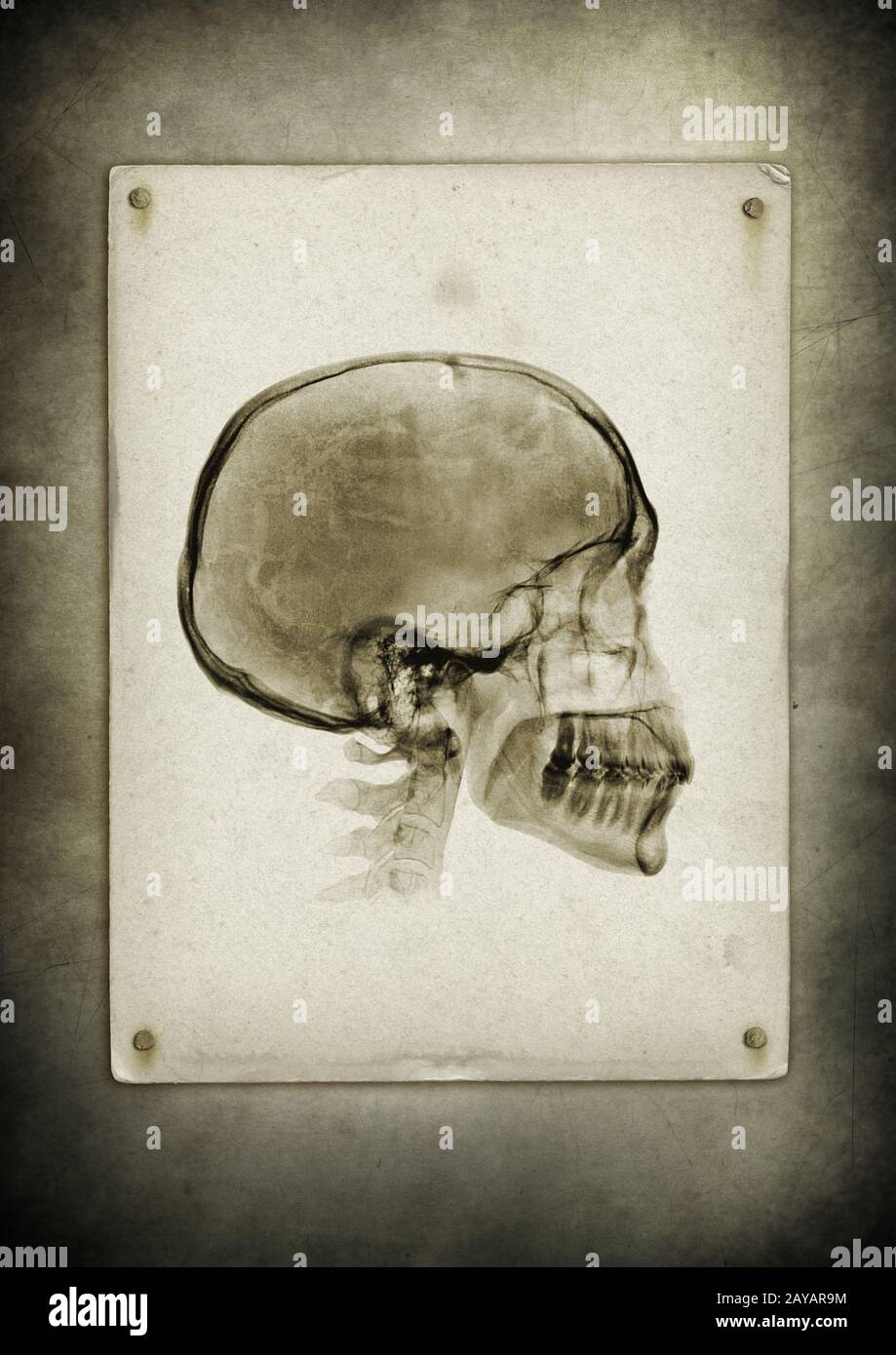 Röntgenschädel auf einem alten Papierhintergrund Stockfoto