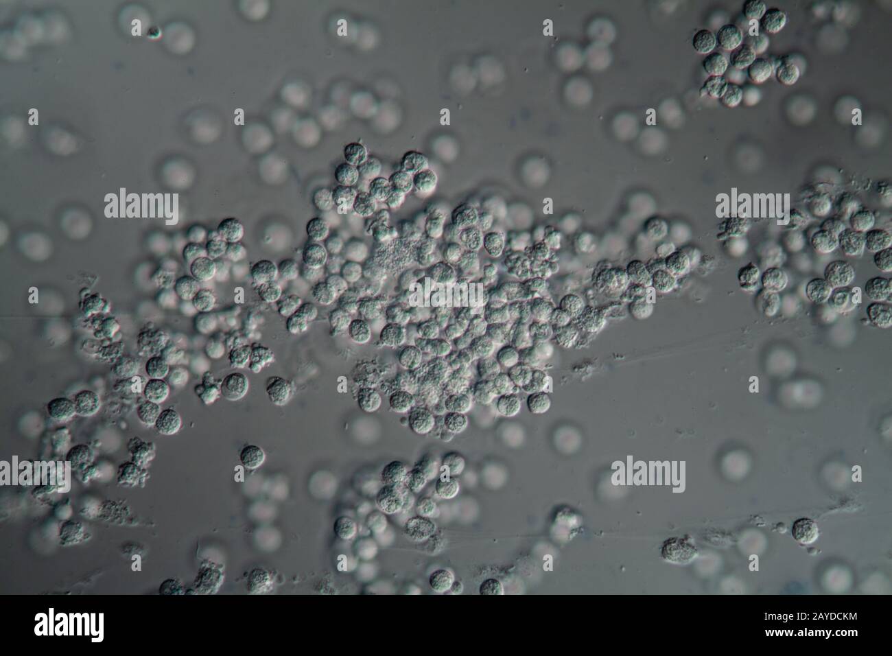 Schleimhautzellepithel aus der menschlichen Blasenwand 400x Stockfoto