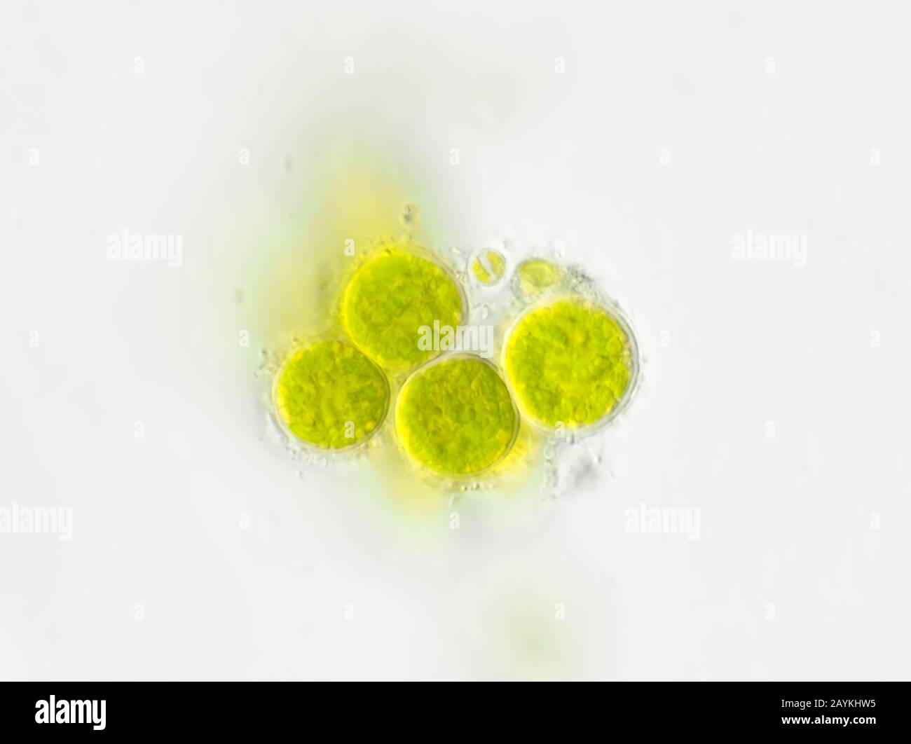 Runde Grünalgen aus vergossenem Pflanzenabflusswasser, fotografiert auf einem Mikroskop mit 100-fachem Ölanteil Stockfoto
