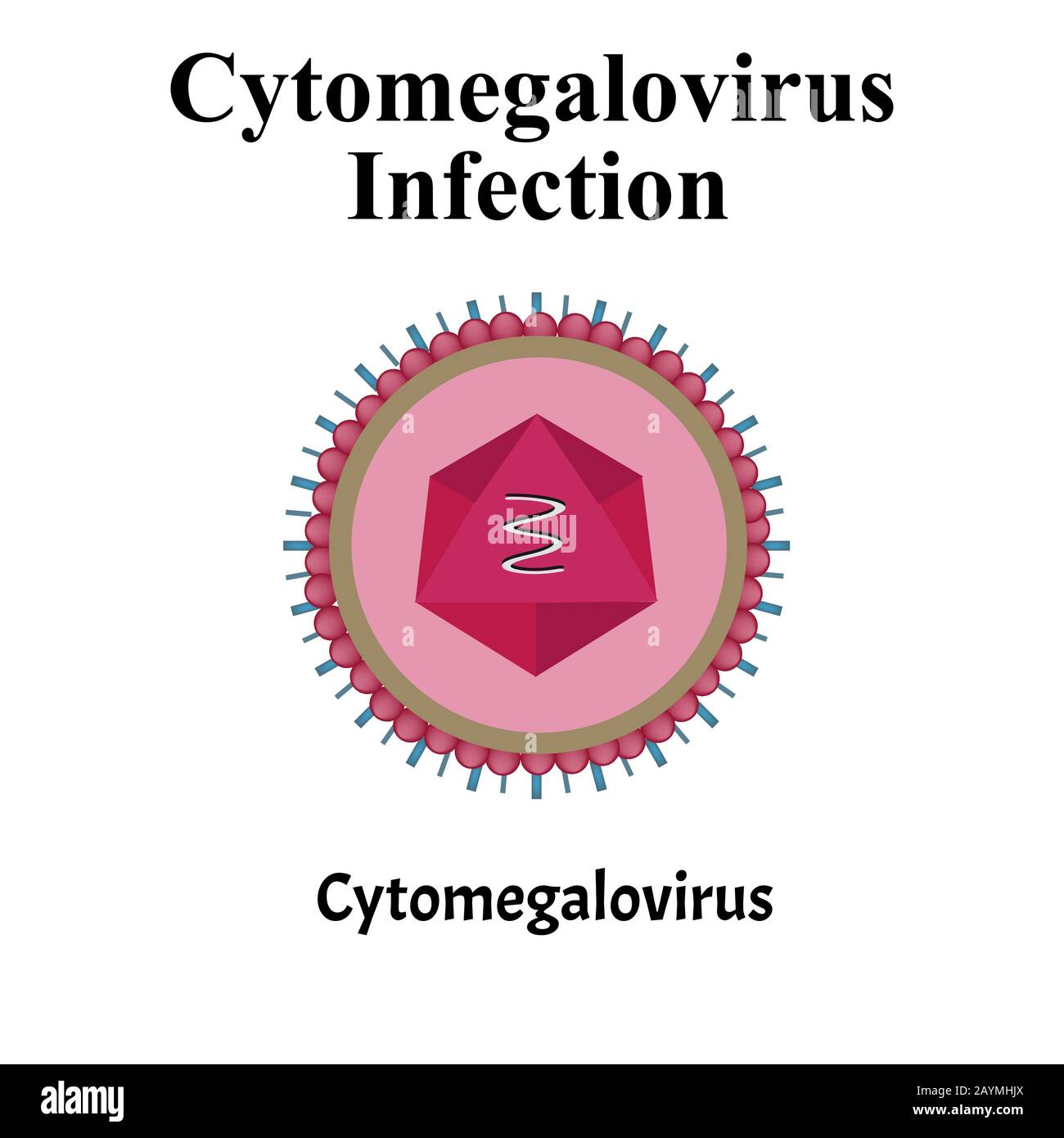 Cytamegalovirus-Struktur. Virusinfektion Zytomegalovirus. Sexuell übertragbare Krankheiten. Infografiken. Vektordarstellung auf isoliertem Hintergrund. Stock Vektor