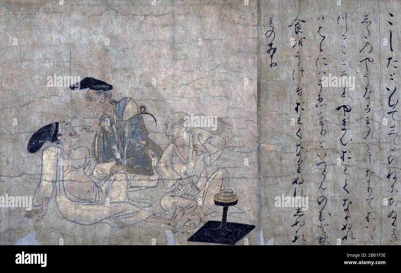 Japan: Einen erkälteten Mann untersuchen. Handscrollen-Gemälde aus dem Yamai no Soshi (Yamai Zoshi) oder „Diseases Scroll“, Mitte des 12. Jahrhunderts CE. Die Shihon Choshoku Yamai no soshi („Krankheiten und Missbildungen“, 紙本著色病草紙) ist eine Handschrift (Emakimono) aus dem späten Heian (12. Jahrhundert), die aus Farbgemälden auf Papier besteht, das zu gegebener Zeit in zehn separate Abschnitte geschnitten wurde. Sie sind im Kyoto National Museum erhalten und als nationales Juwel Japans gelistet. Stockfoto