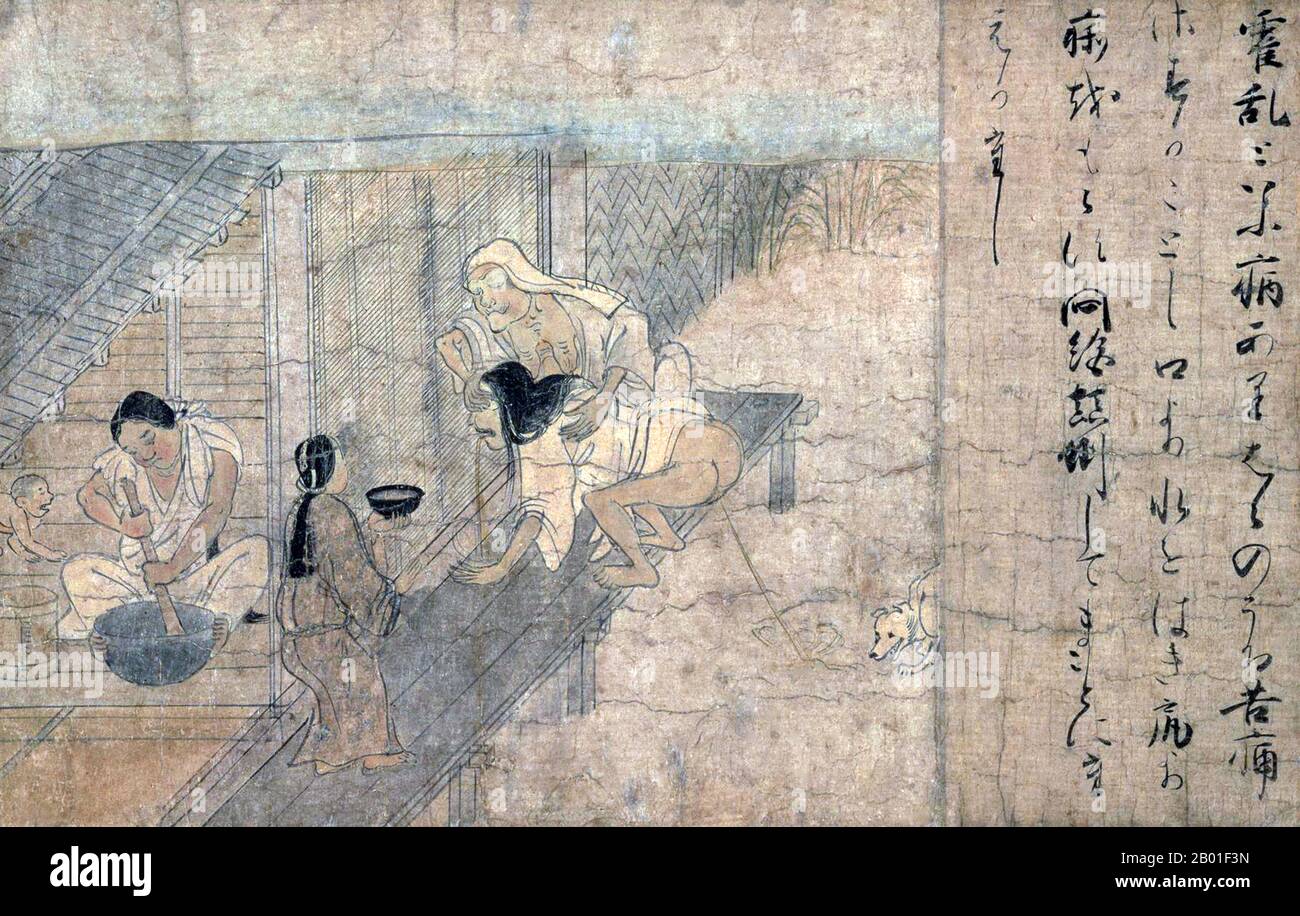 Japan: Eine Frau, die an Cholera leidet. Handscrollen-Gemälde aus dem Yamai no Soshi (Yamai Zoshi) oder „Diseases Scroll“, Mitte des 12. Jahrhunderts CE. Die Shihon Choshoku Yamai no soshi („Krankheiten und Missbildungen“, 紙本著色病草紙) ist eine Handschrift (Emakimono) aus dem späten Heian (12. Jahrhundert), die aus Farbgemälden auf Papier besteht, das zu gegebener Zeit in zehn separate Abschnitte geschnitten wurde. Sie sind im Kyoto National Museum erhalten und als nationales Juwel Japans gelistet. Stockfoto