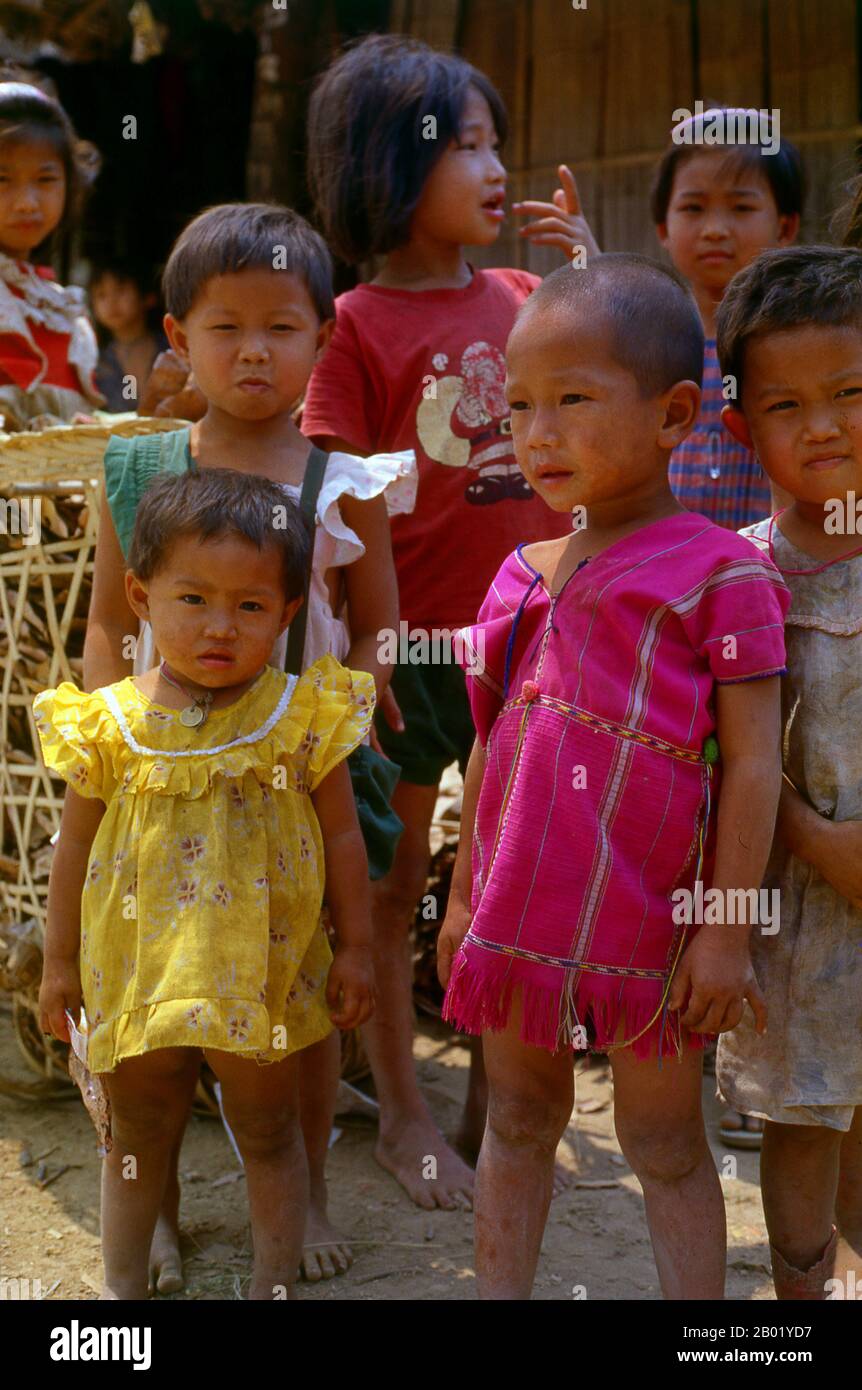 Die Karen- oder Kayin-Menschen (Pwa Ka Nyaw PoE oder Kanyaw in Sgaw Karen und Ploan in PoE Karen; Kariang oder Yang in Thai) sind eine Chinesisch-tibetisch sprechende ethnische Gruppe, die hauptsächlich im südlichen und östlichen Birma (Myanmar) lebt. Die Karen machen etwa 7 Prozent der gesamten birmanischen Bevölkerung von etwa 50 Millionen Menschen aus. Auch eine große Anzahl von Karen lebt in Thailand, meist an der thailändisch-birmanischen Grenze. Die Karen werden oft mit den Roten Karen (oder Karenni) verwechselt. Eine Untergruppe der Karenni, der Stamm der Padaung aus der Grenzregion Birma und Thailand, sind die besten KNO Stockfoto