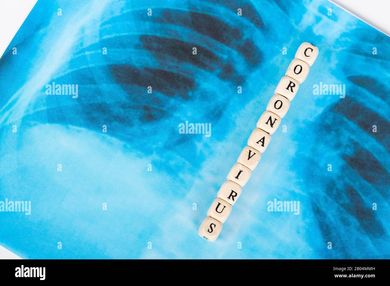 Roman Covid-19, Wuhan-Virus-Konzept aus China. Textphrase Coronavirus mit Holzbuchstabe auf dem blauen Bildhintergrund der Lunge Radiologie. Kopierbereich. Stockfoto