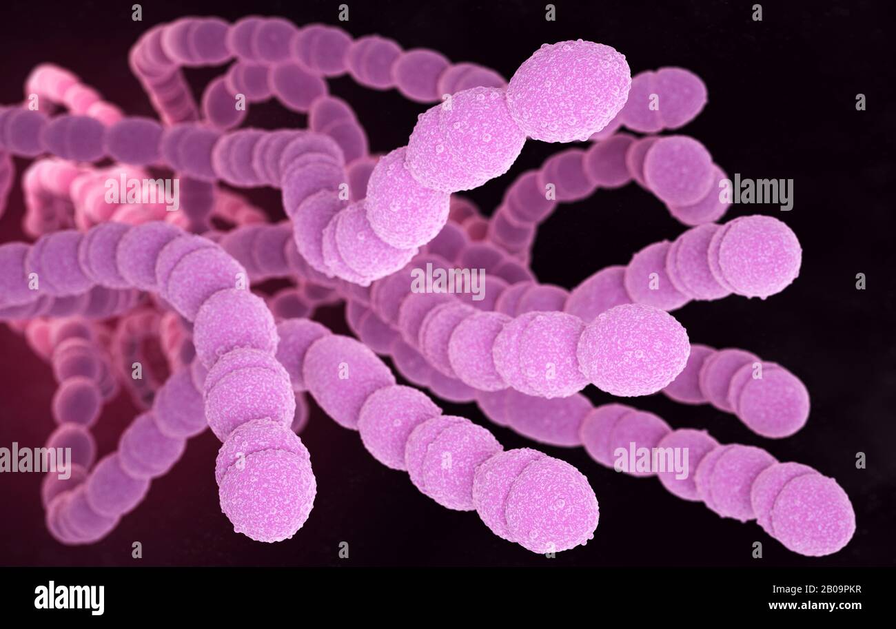 Streptococcus pneumoniae, oder Pneumokokken, ist Gram-positive coccus-förmige pathogene Bakterien, die viele Arten von Pneumokokken-Infektionen in AD verursachen Stockfoto