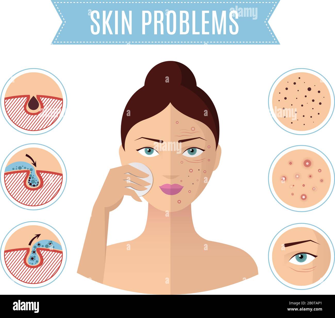 Hautprobleme lösen, Akne Behandlung und Reinigung Pore für perfekte Womane Gesicht Vektor-Symbole. Problem mit dem Gesicht der Haut, Abbildung der Gesichtshaut der Schönheit Stock Vektor