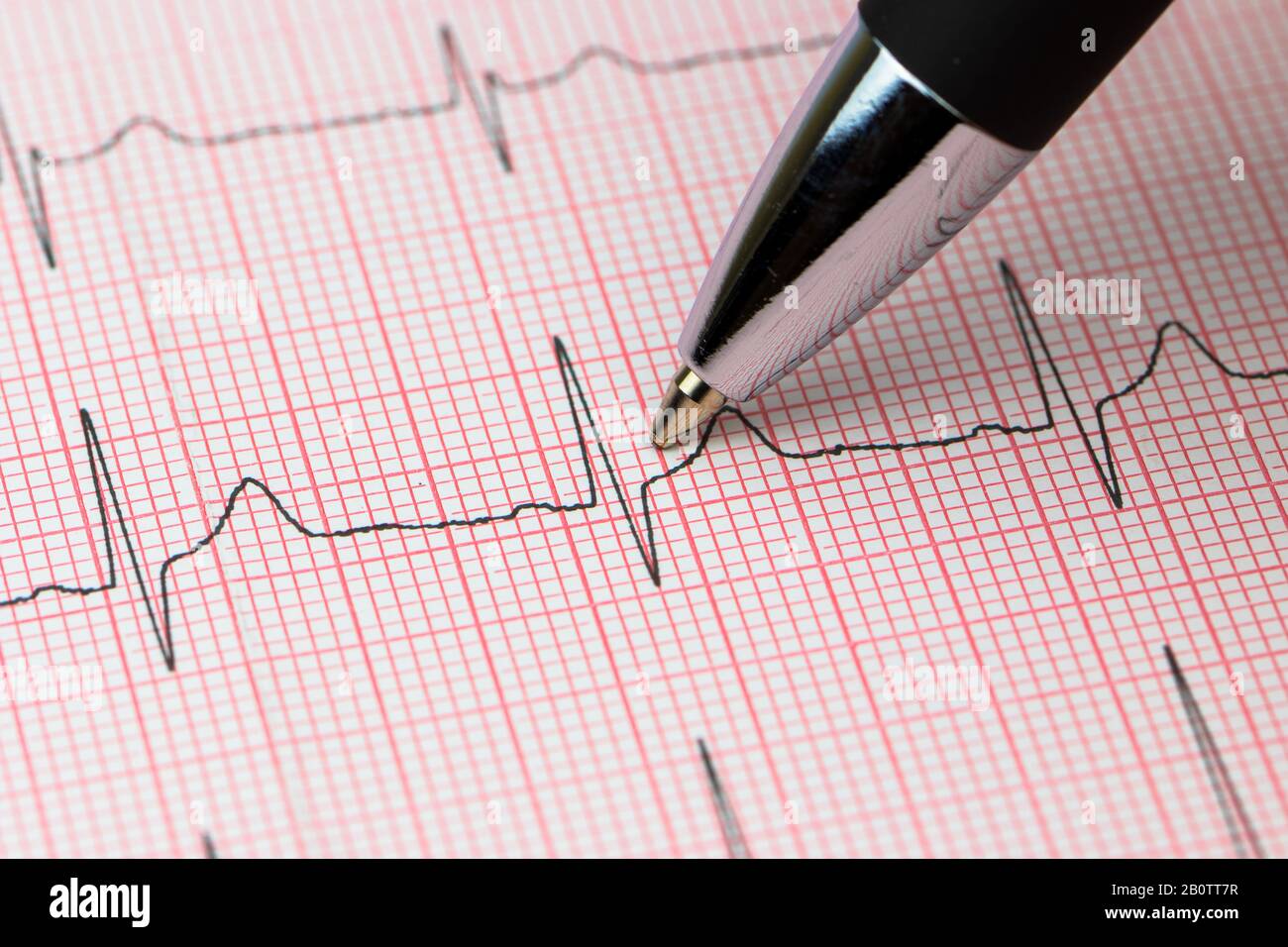 Reelle Linie eines elektroikalen Kardiogramms Stockfoto