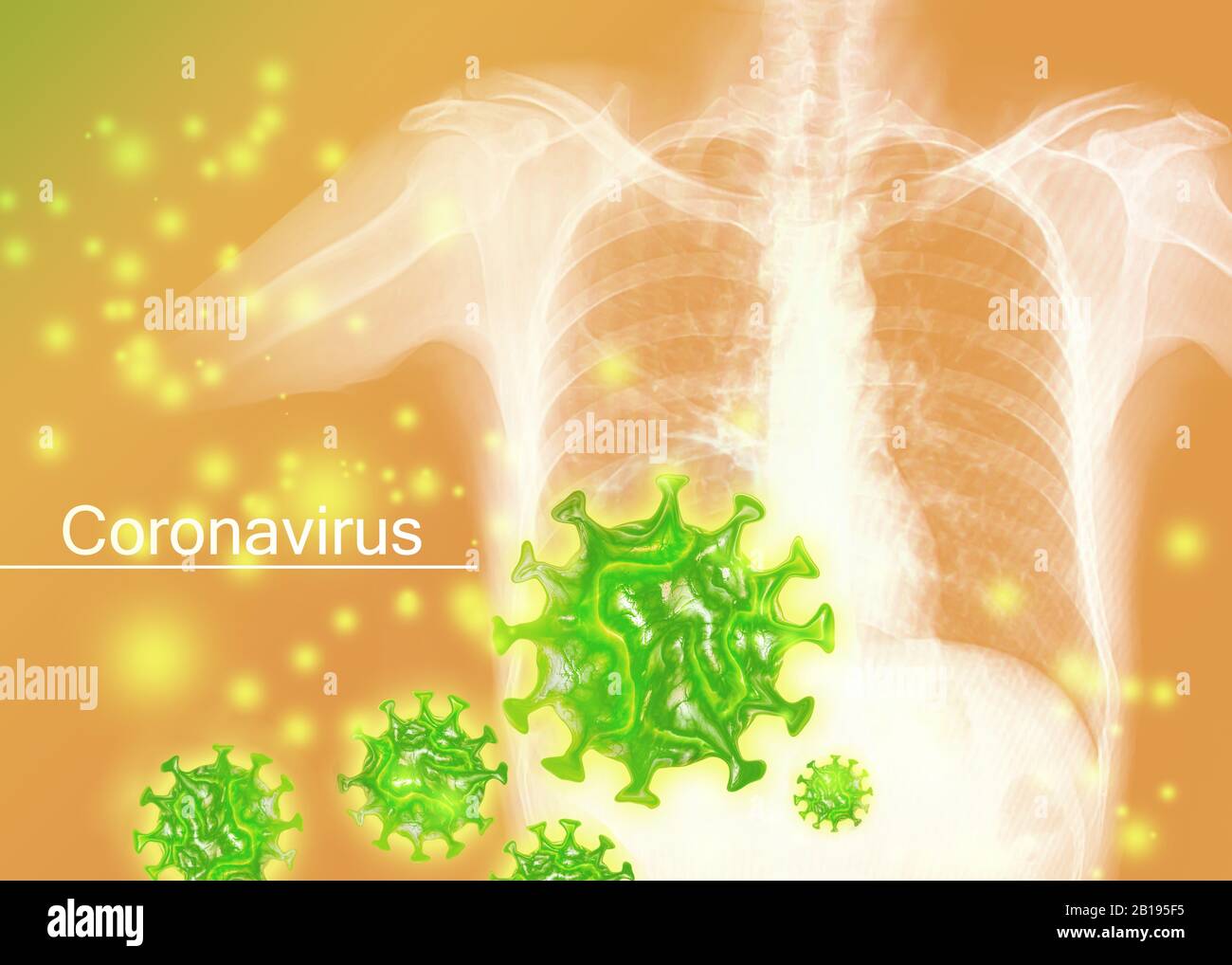 Corona-Virus-Coronavirus-Konzept mit Lunge Stockfoto