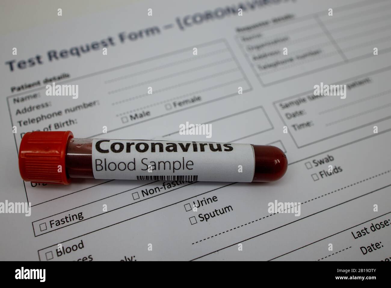 Blutprobe für das neue, sich schnell ausbreitende Coronavirus, das seinen Ursprung in Wuhan, China hat. Reagenzglas mit leerem Formular für Bluttests für Kovid 19 Stockfoto