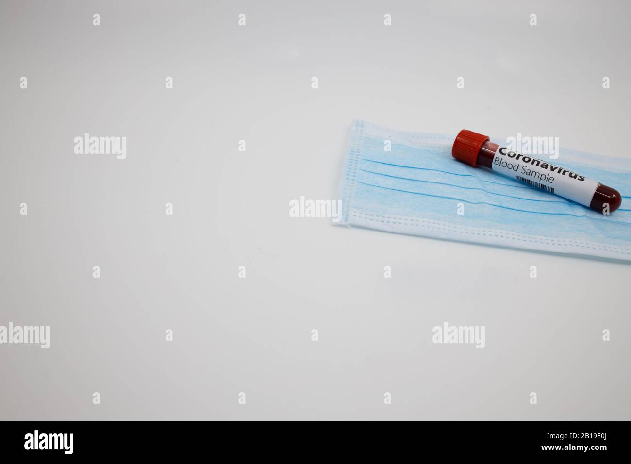 Blutprobe für das neue, sich schnell ausbreitende Coronavirus, das seinen Ursprung in Wuhan, China hat. Reagenzglas auf blauer Operationsmaske und weißem Hintergrund mit Co Stockfoto