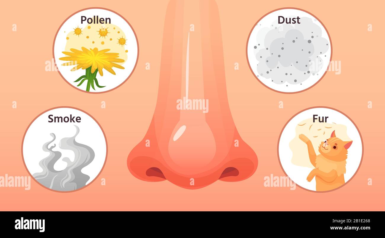 Allergische Krankheit. Rote Nase, Allergieerkrankungen Symptome und Allergene. Cartoon-Vektorgrafiken für Rauch-, Pollen- und Stauballergien Stock Vektor