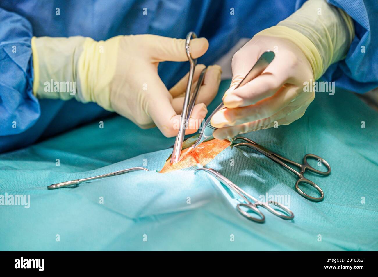 Nahaufnahme, Hände des professionellen Chirurgen, der operiert. Im Hintergrund Modern Hospital Operation Room . Stockfoto