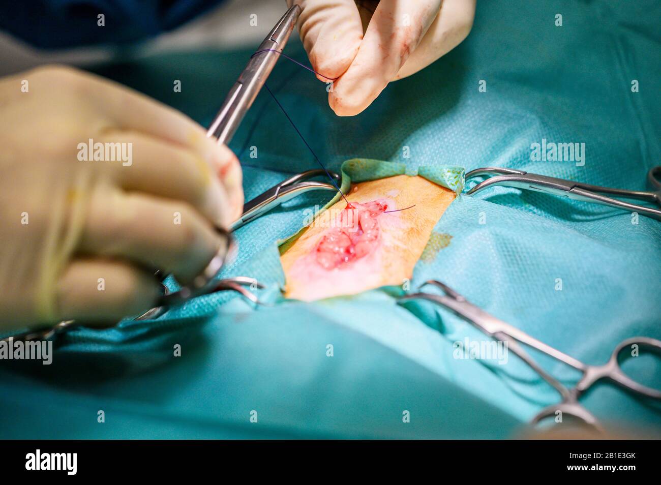 Vorgang bei einem Patienten. Die Hände des Chirurgen in Schutzhandschuhen, die mit medizinischen Werkzeugen operiert werden. Stockfoto