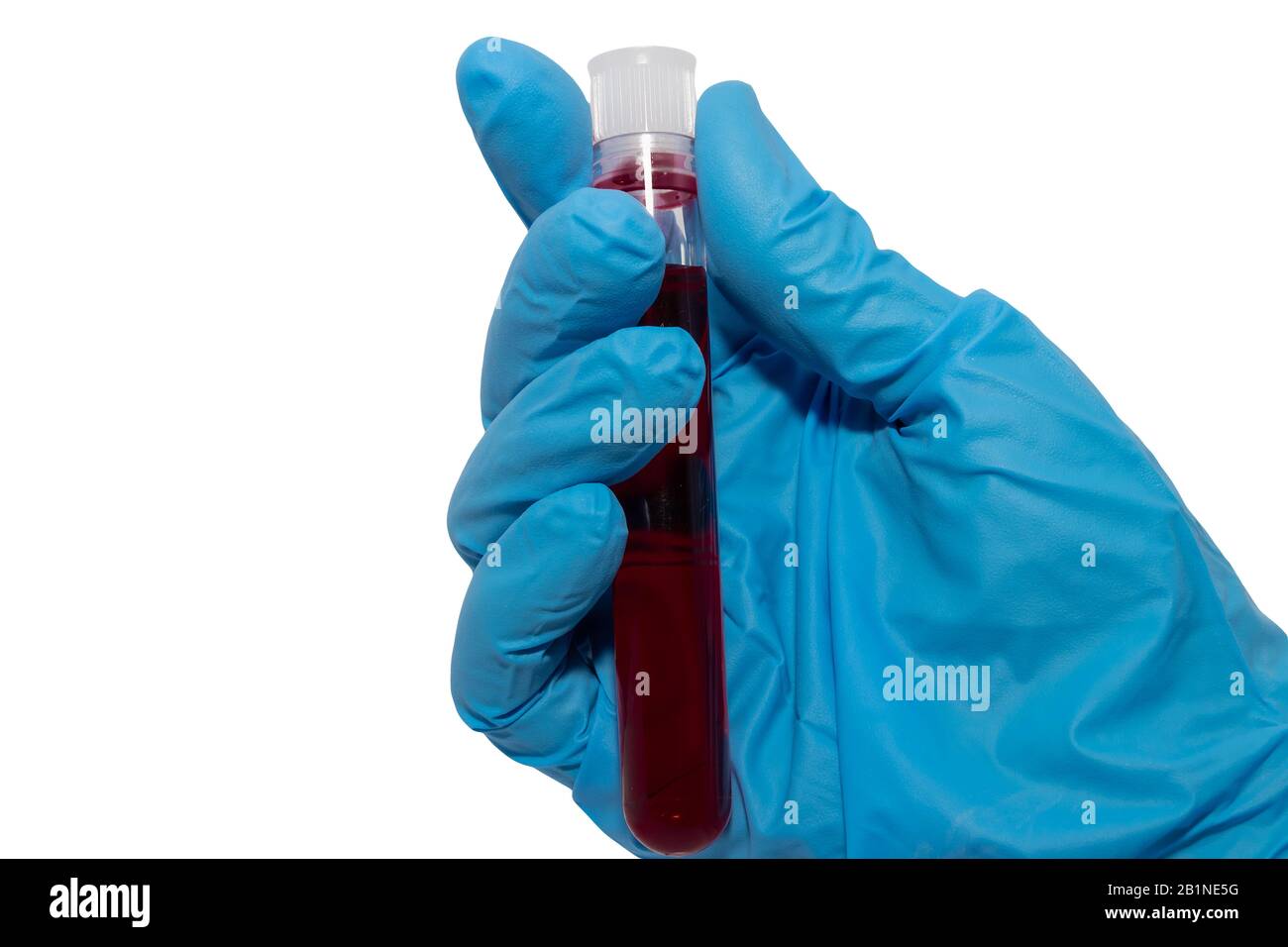 Hand eines Labortechnikers mit einem Röhrchen Blutprobe Stockfoto